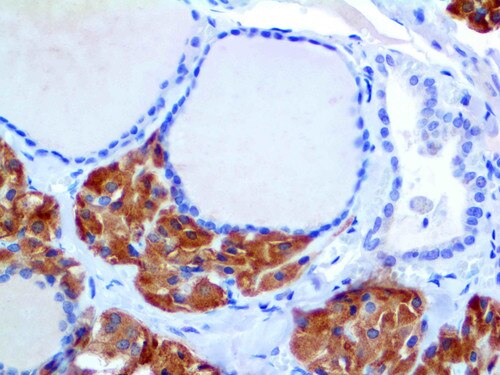 IHC of Calcitonin on an FFPE Thyroid Tissue